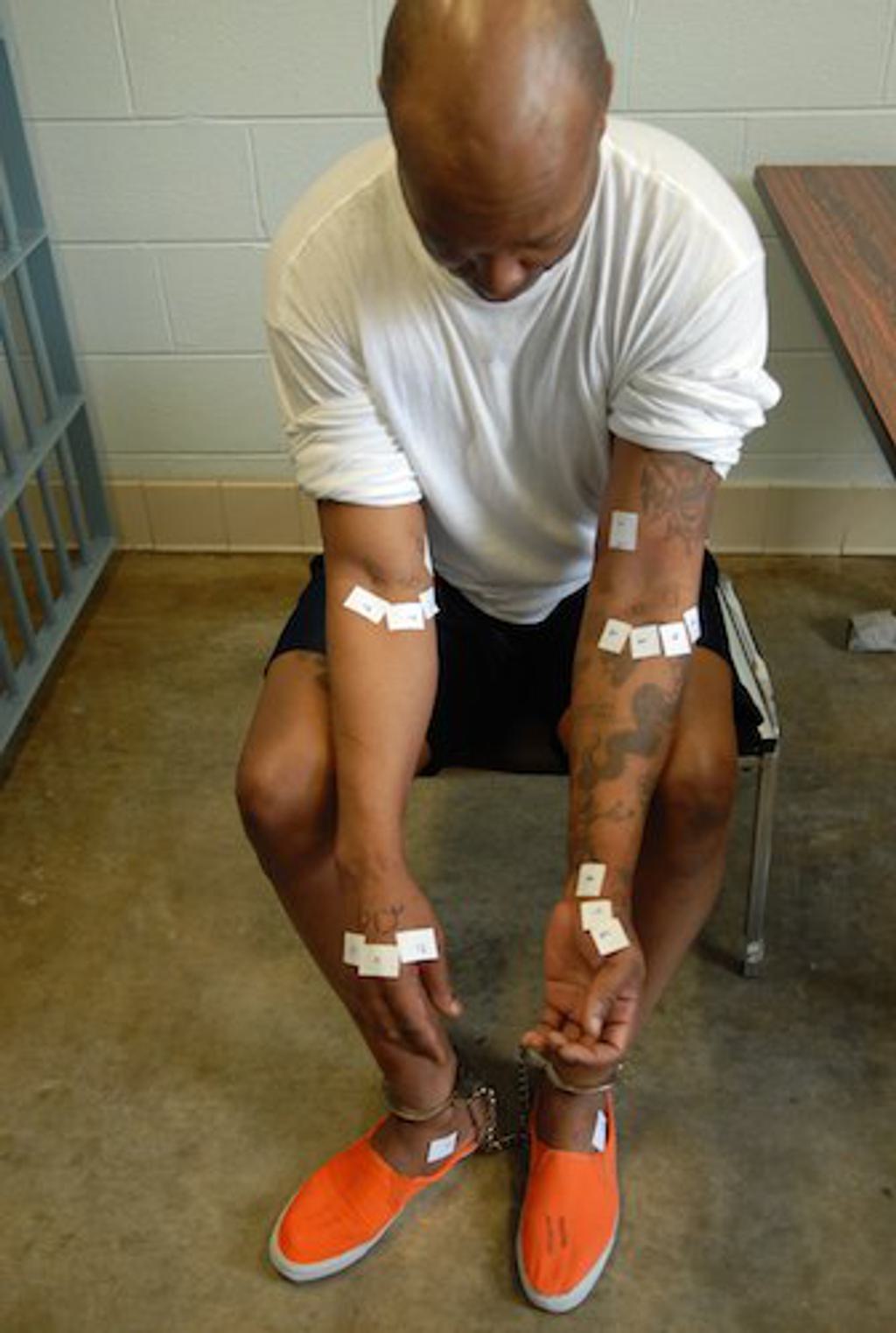 Romell Broom displays the 18 different locations in which Ohio execution personnel unsuccessfully attempted to set an intravenous line to execute him in September 2009.